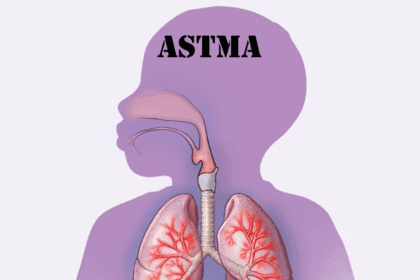 Šest pokretača astme koje ne biste očekivali